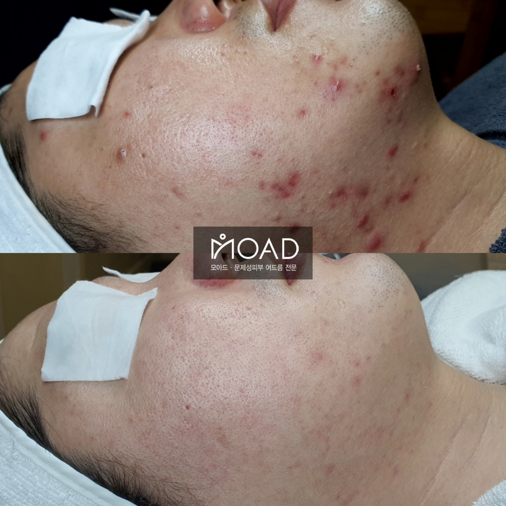 모아드 대표 이미지