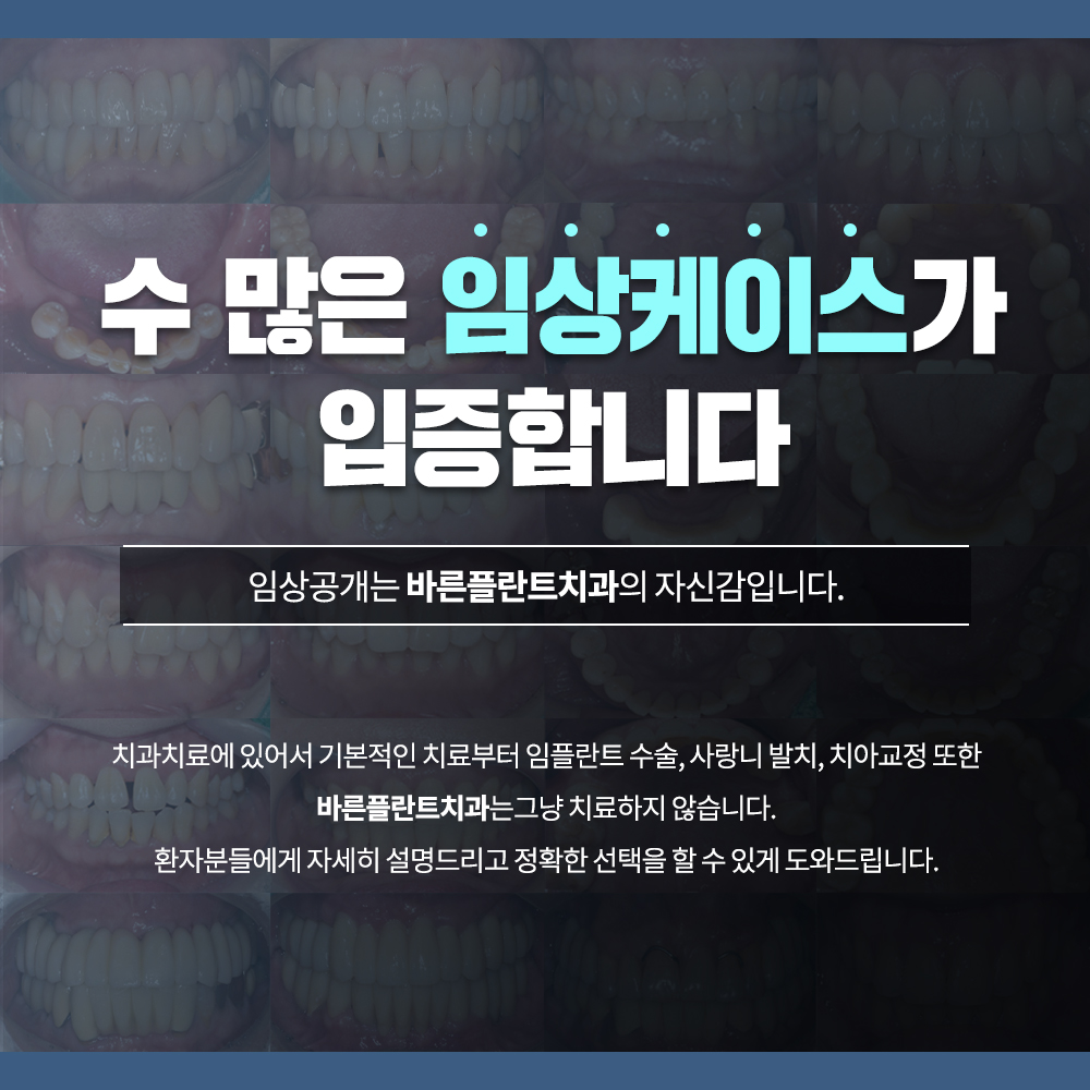 바른플란트치과의원 망우동 대표 이미지