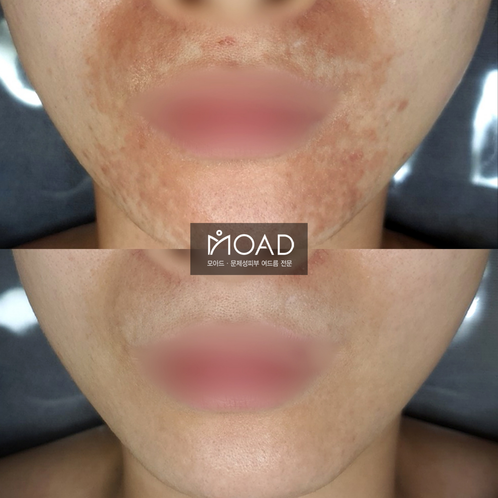 모아드 대표 이미지