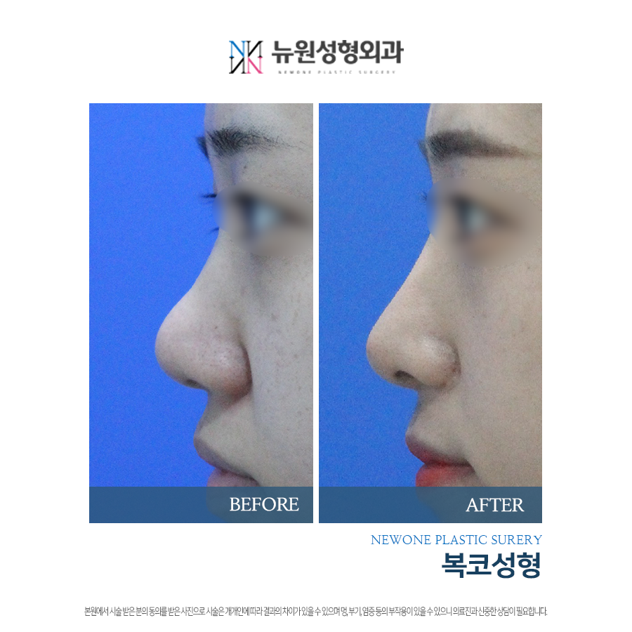 뉴원성형외과의원