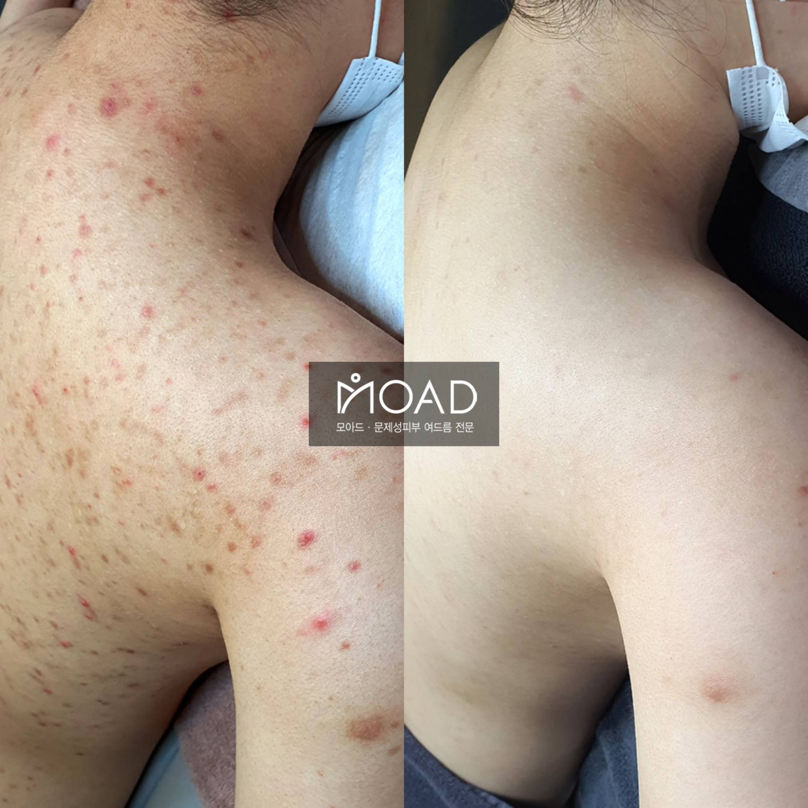 모아드 대표 이미지