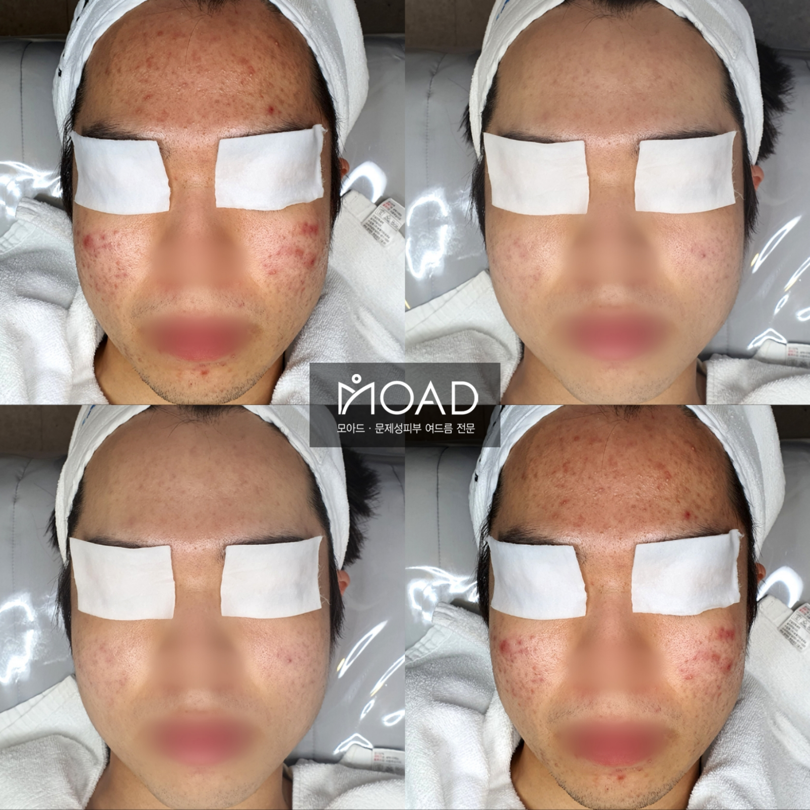 모아드 대표 이미지