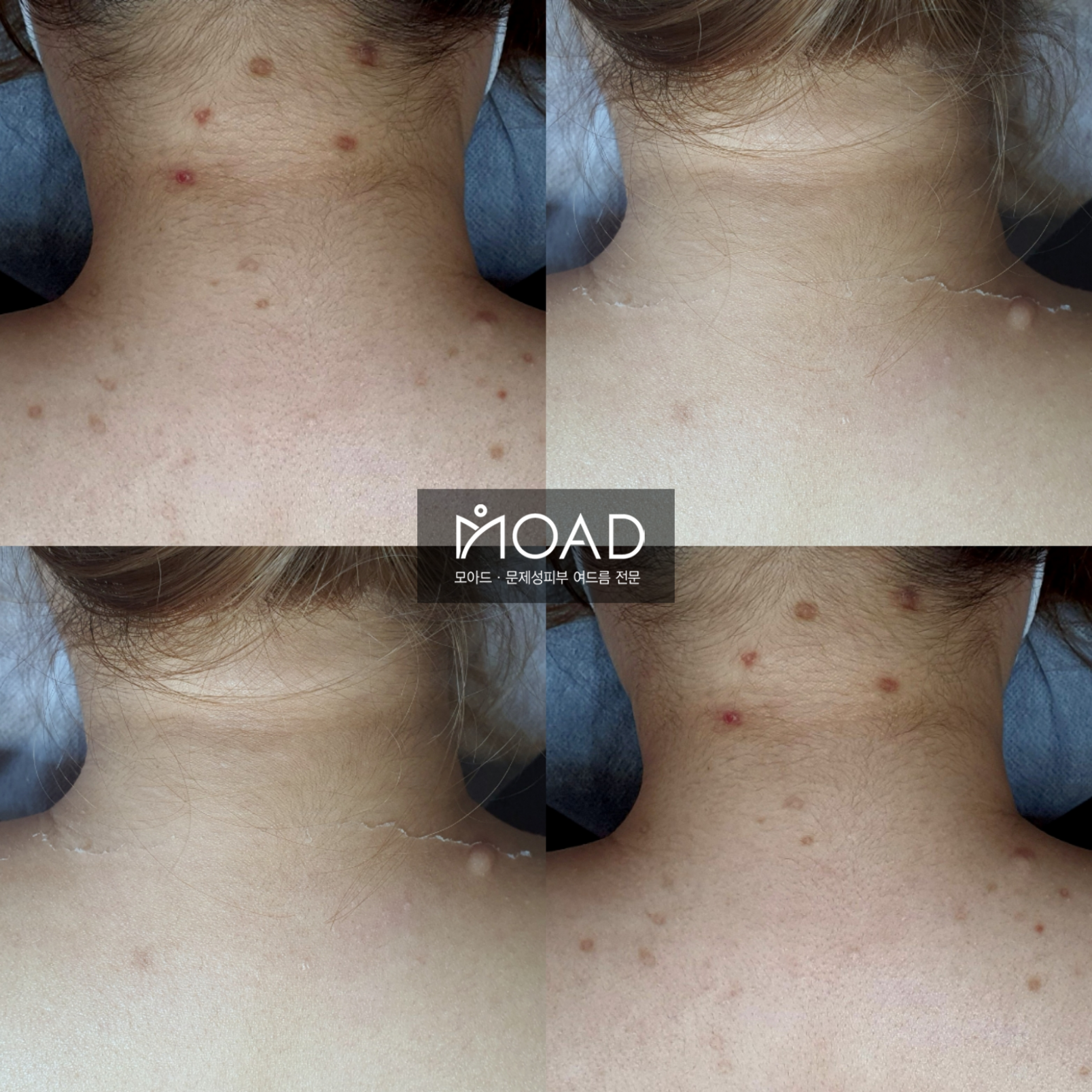 모아드 대표 이미지