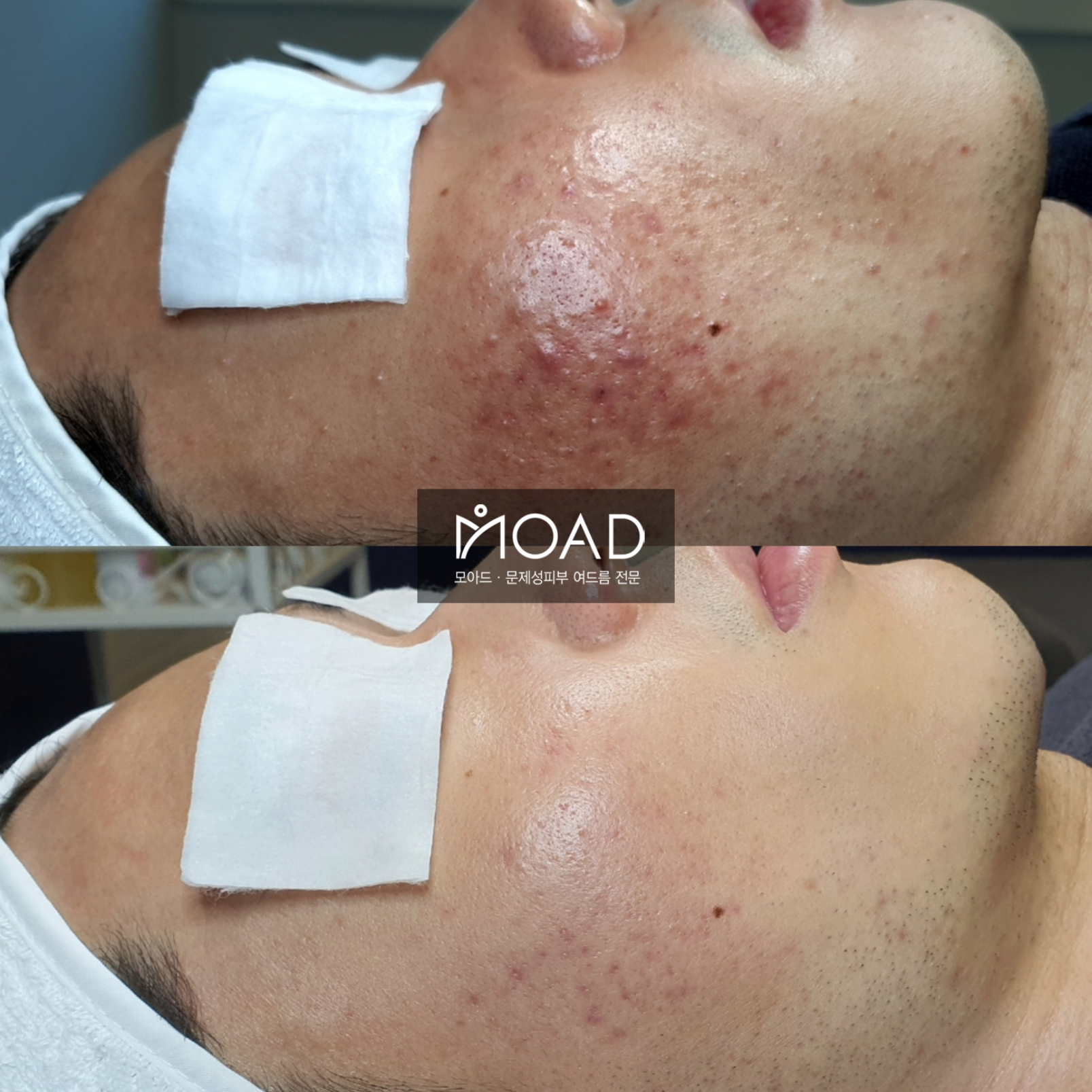 모아드 대표 이미지