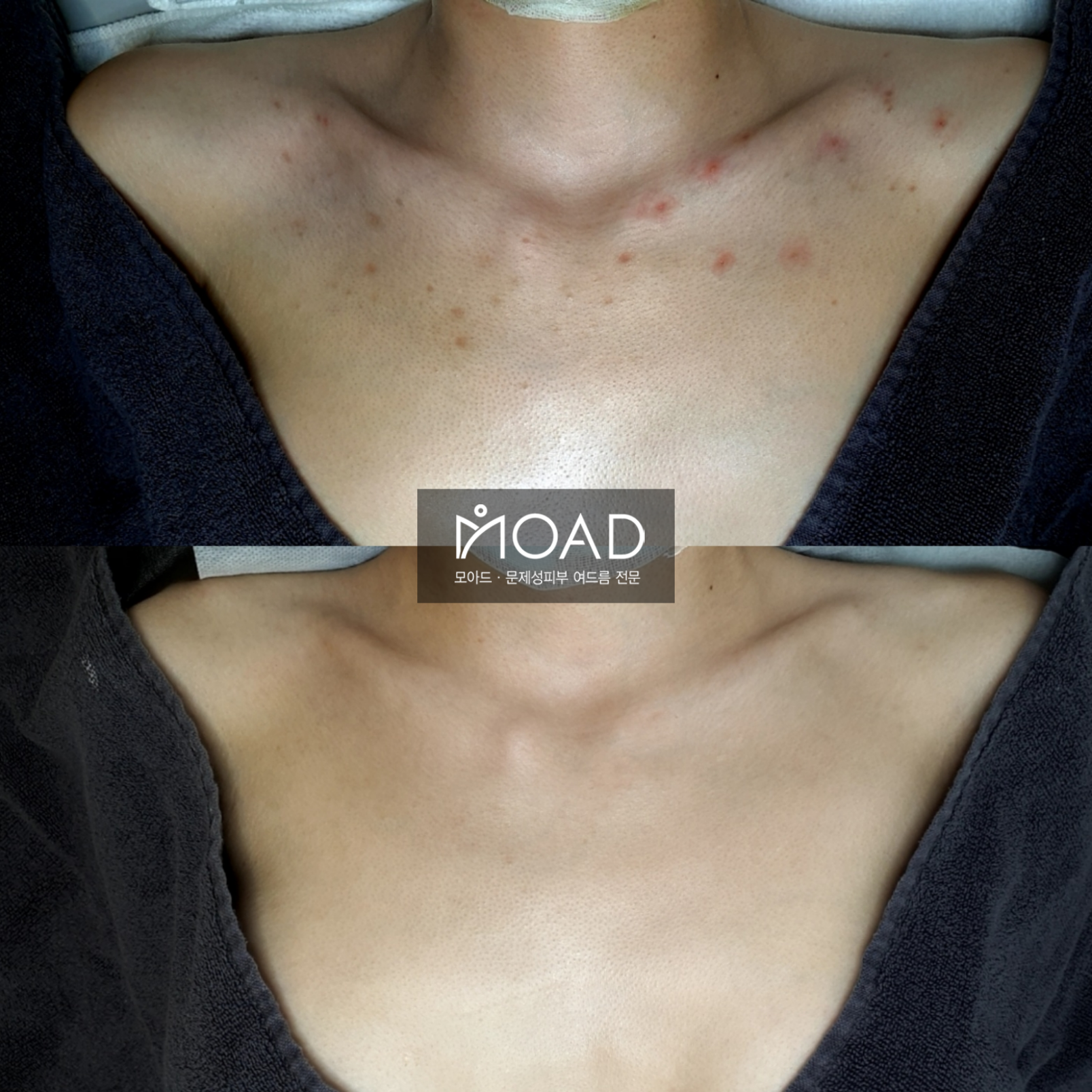 모아드 대표 이미지