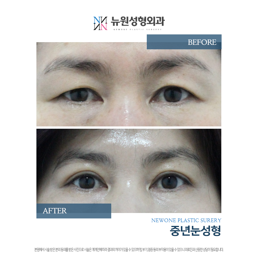 뉴원성형외과의원