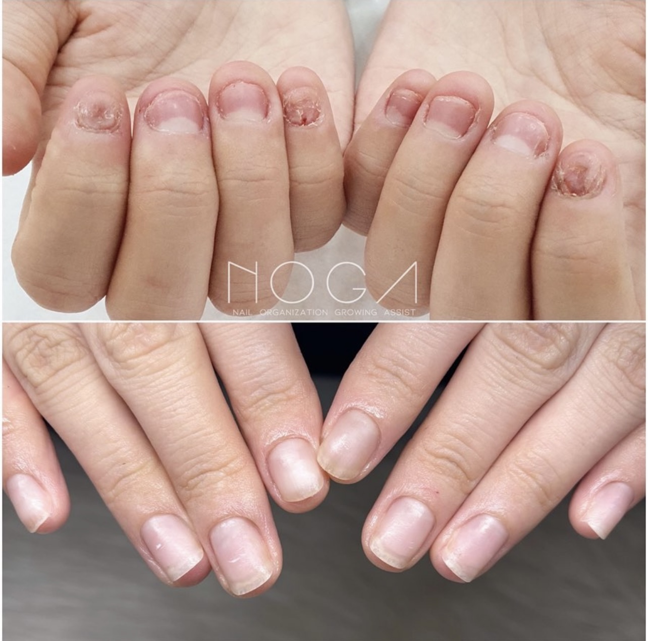 데이지네일 대표 이미지