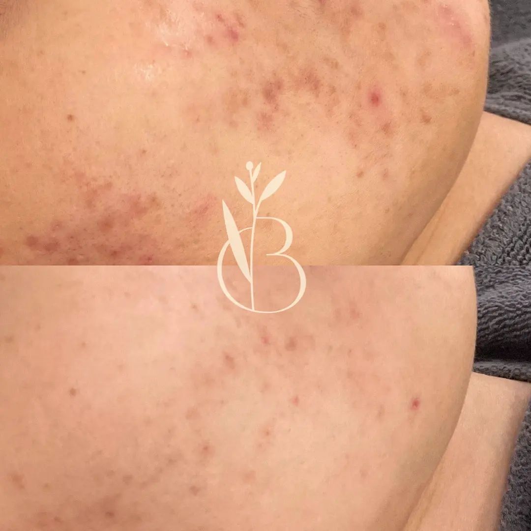 뷰티온리 의정부