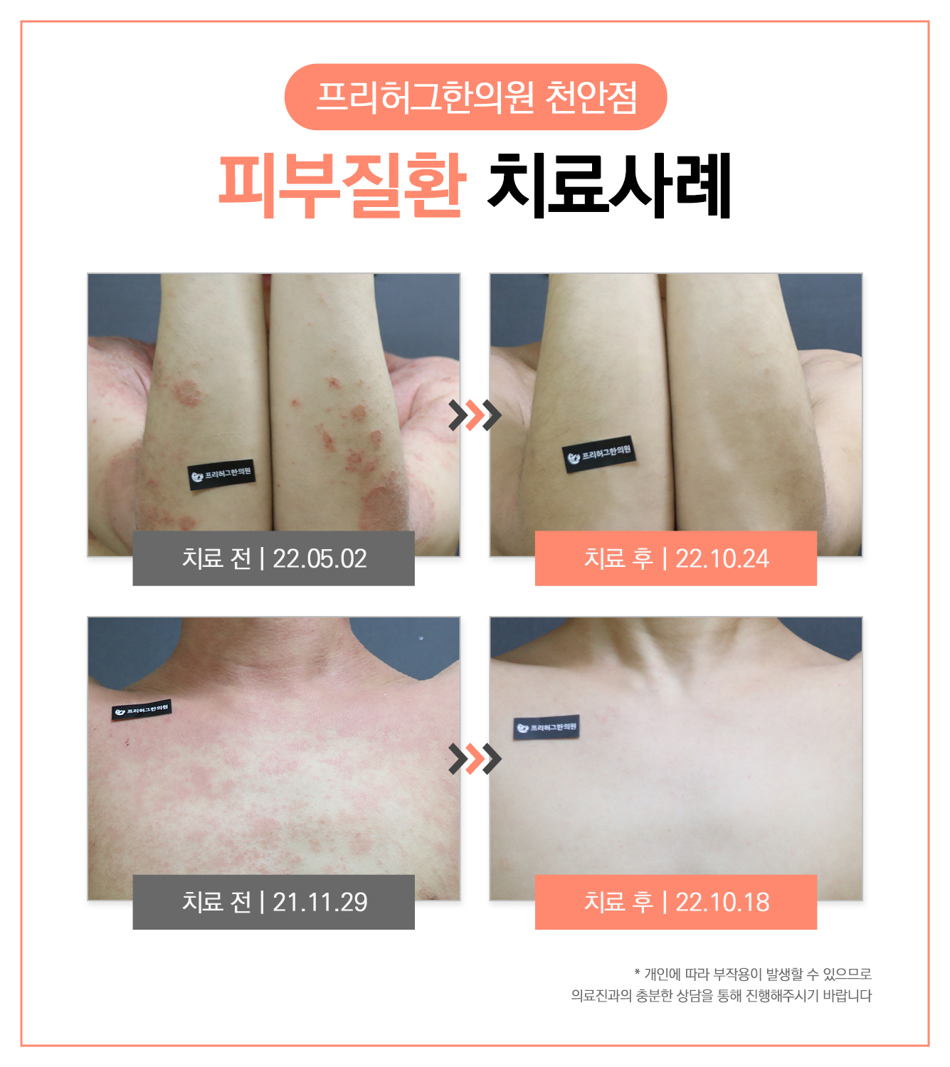 프리허그한의원 천안 대표 이미지