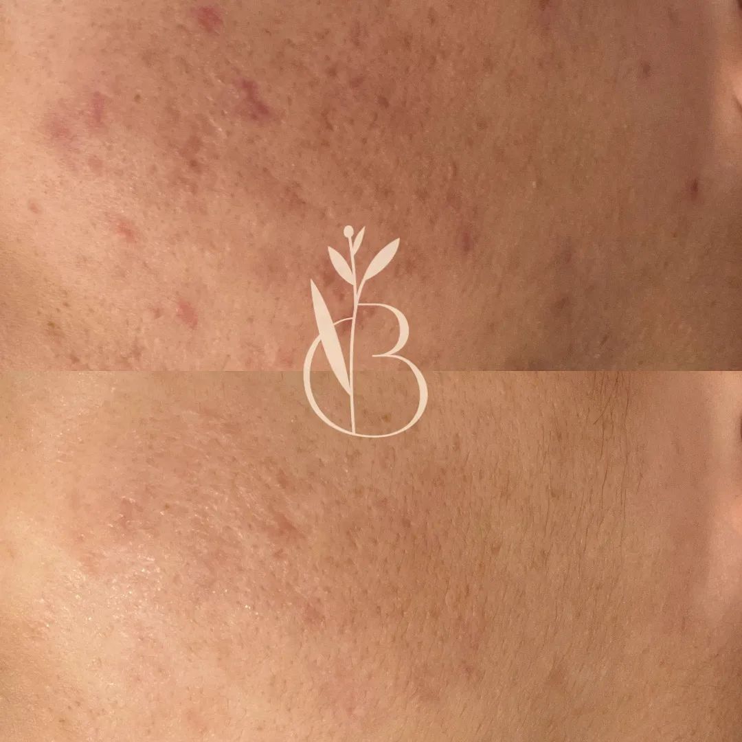 뷰티온리 대표 이미지