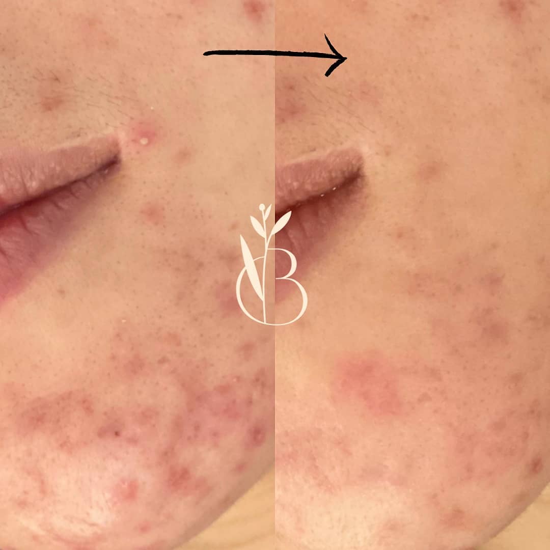 뷰티온리 의정부본점 대표 이미지