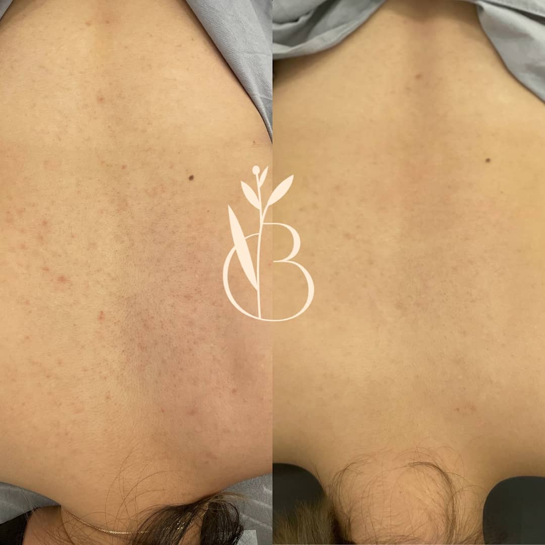 뷰티온리 의정부본점 대표 이미지