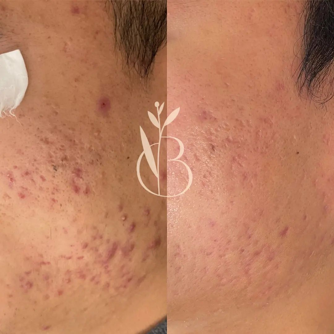 뷰티온리 의정부본점 대표 이미지