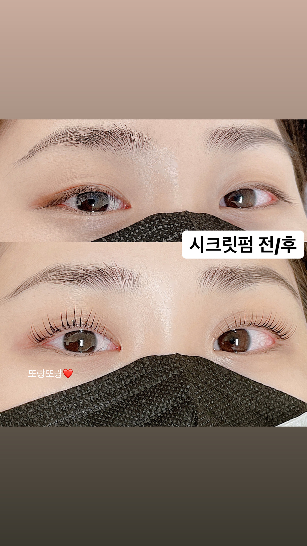 미니도트 대표 이미지