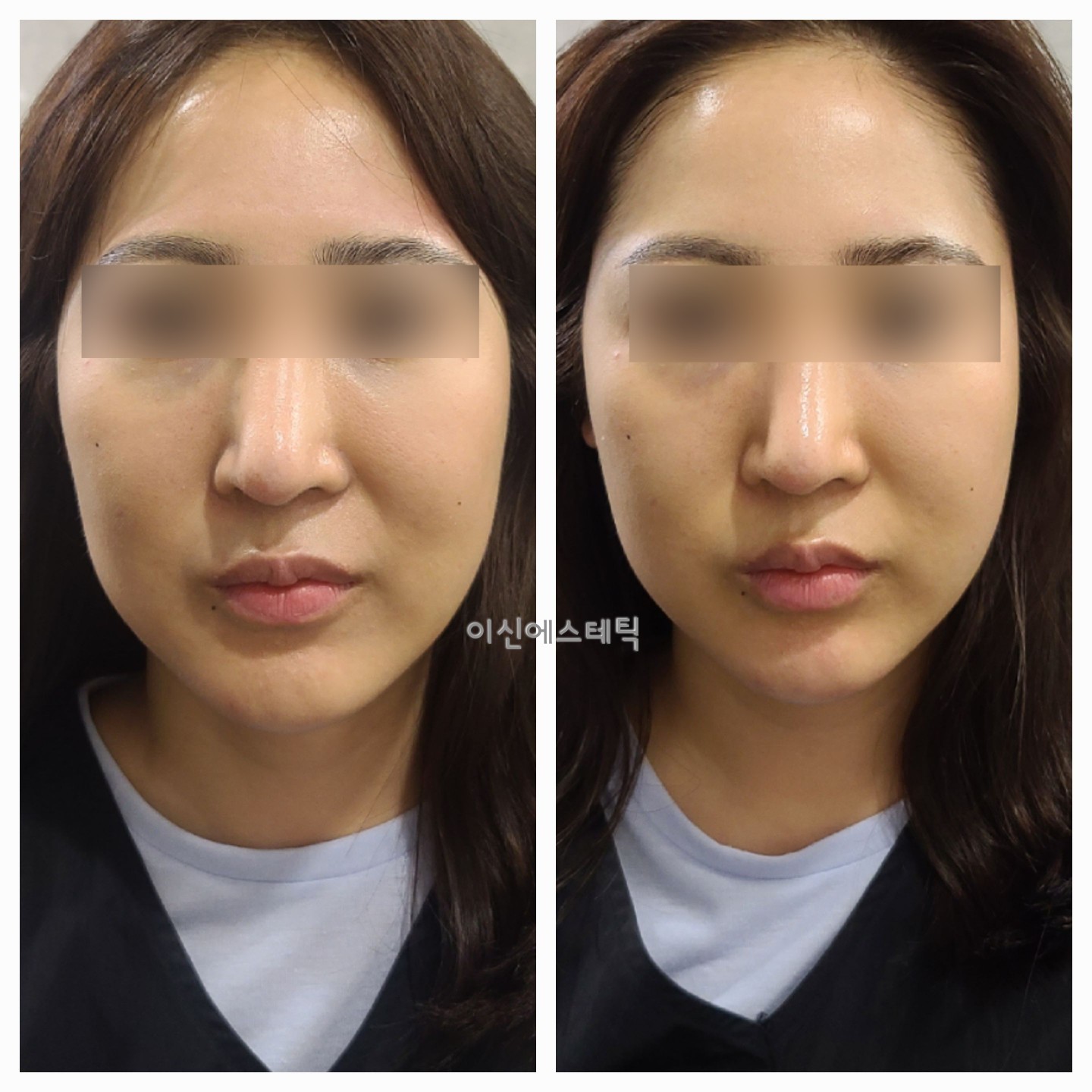 이신에스테틱 부산하단점