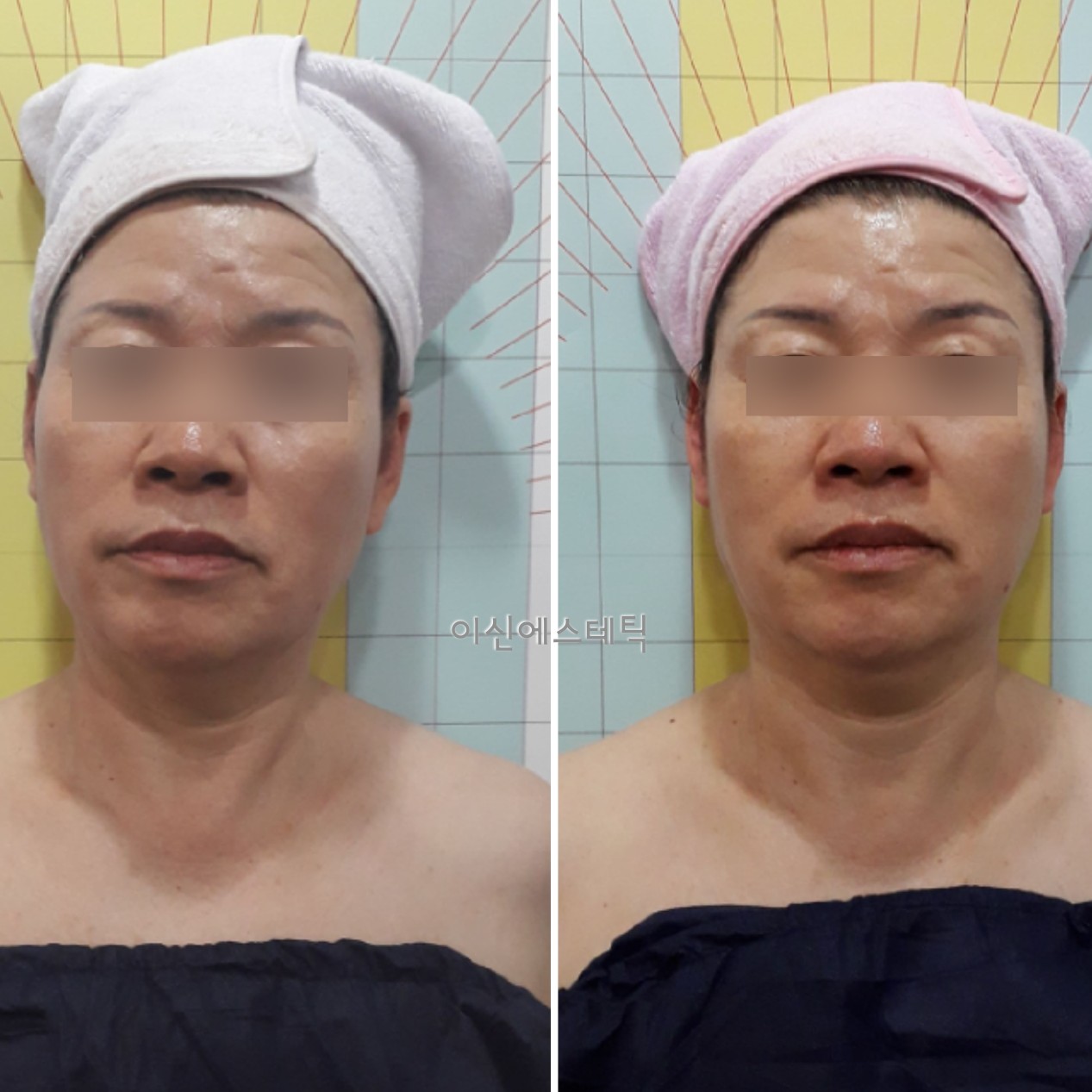 이신에스테틱 부산하단점