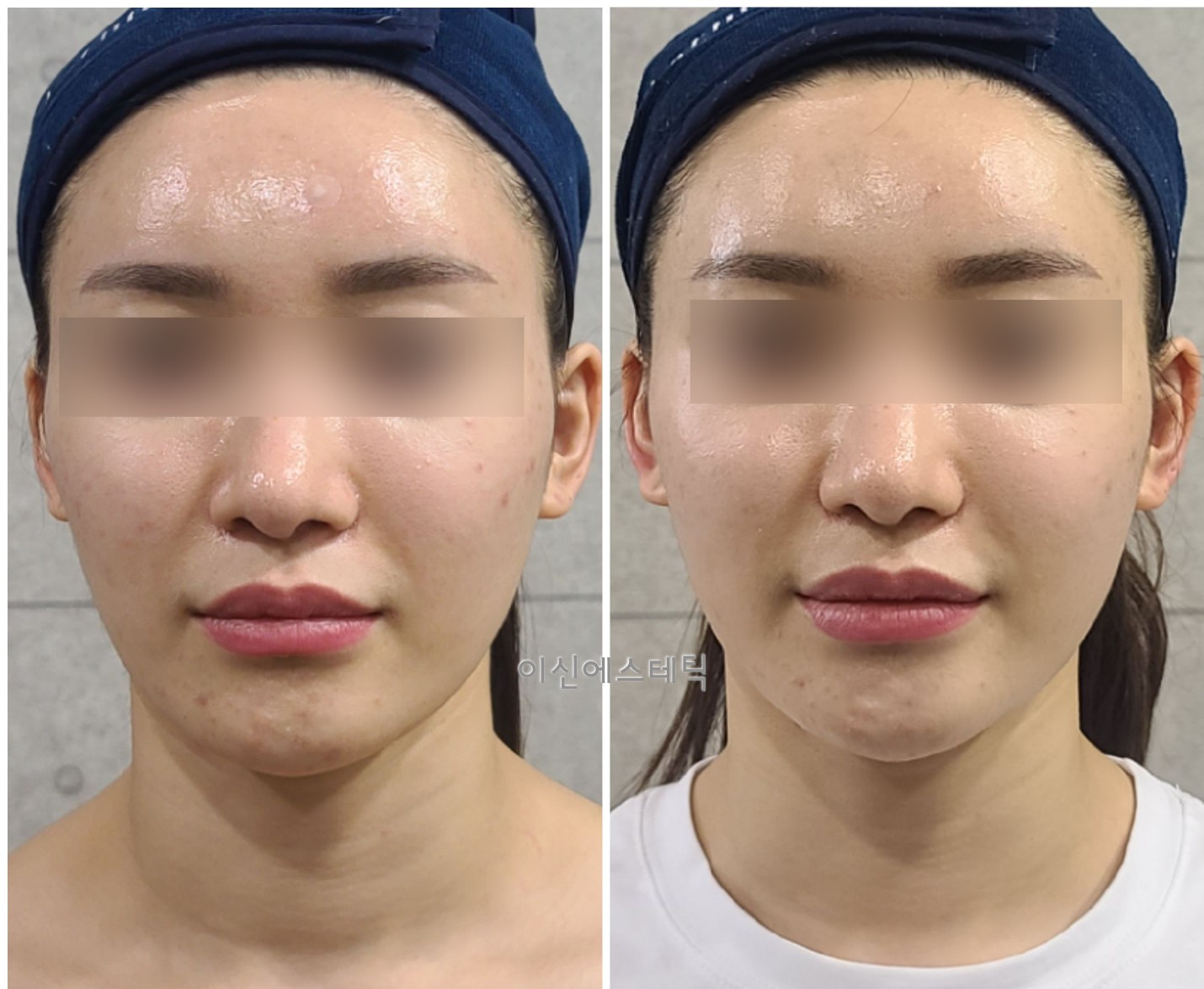 이신에스테틱 부산하단점