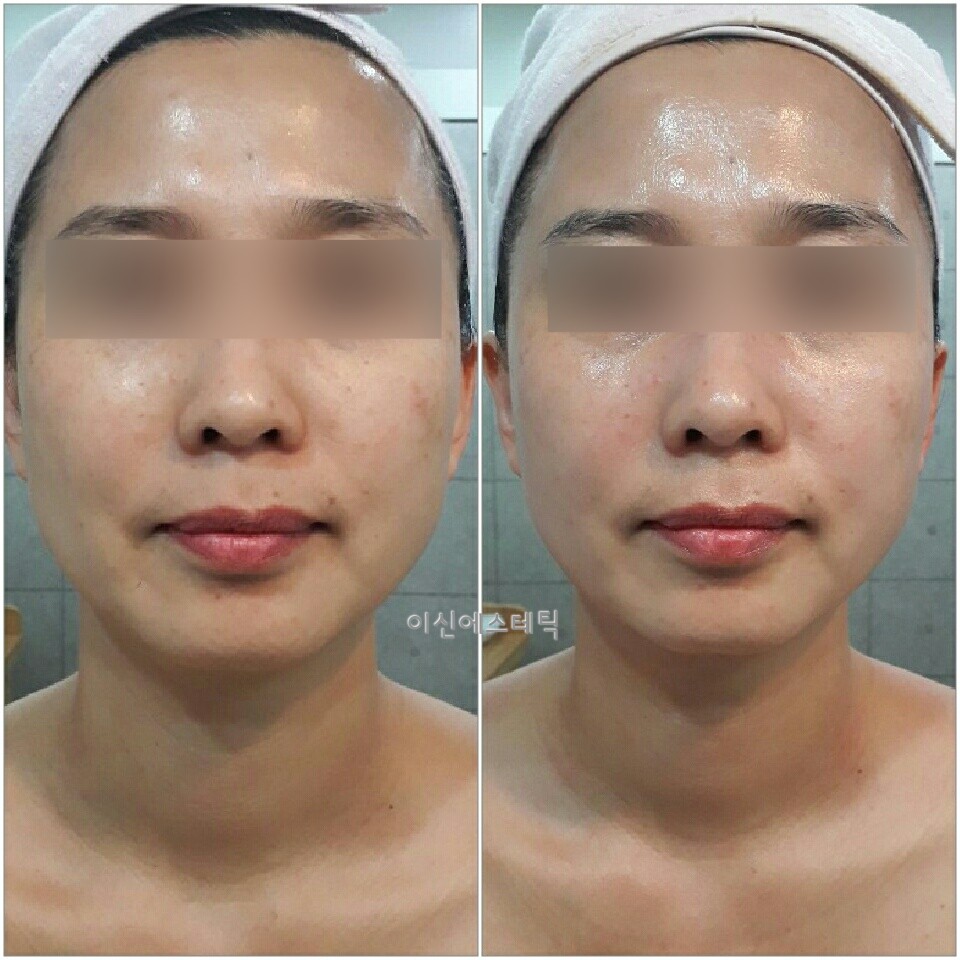 이신에스테틱 부산하단점