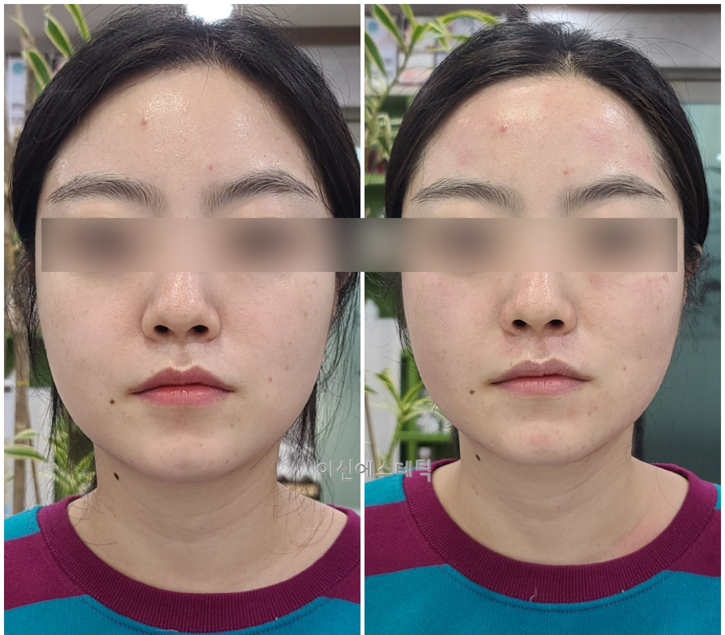 이신에스테틱 부산하단점