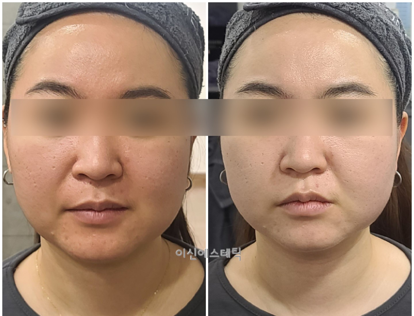 이신에스테틱 부산하단점