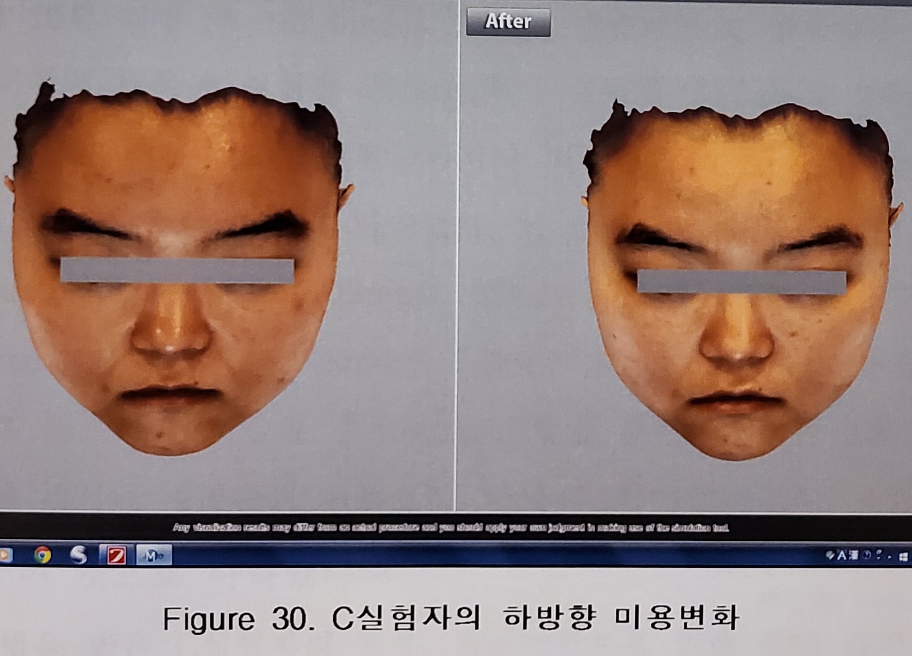 에스테틱 소정