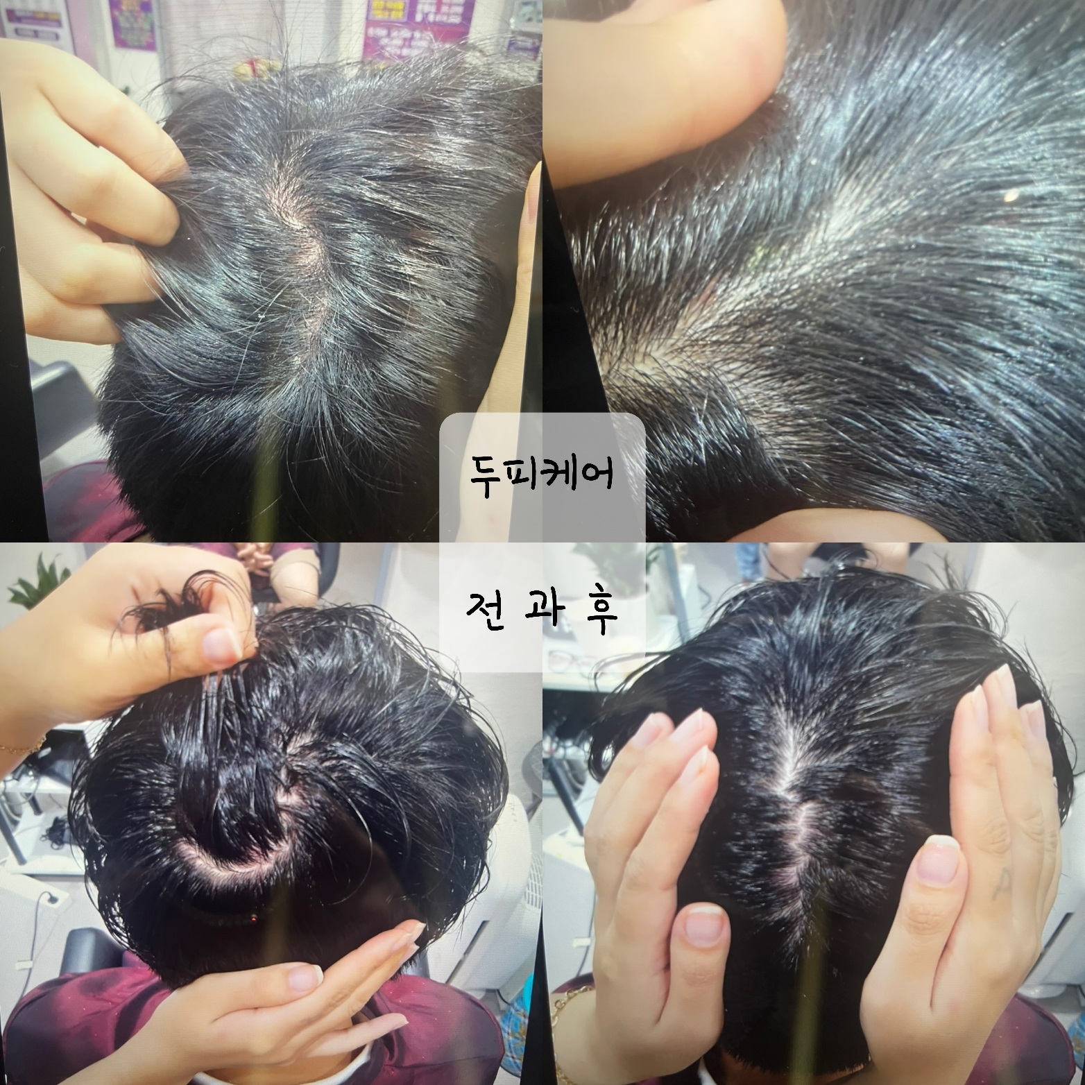 수앤큐사랑 염색 피부관리 속눈썹 두피탈모