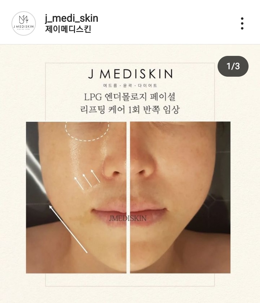 제이메디스킨