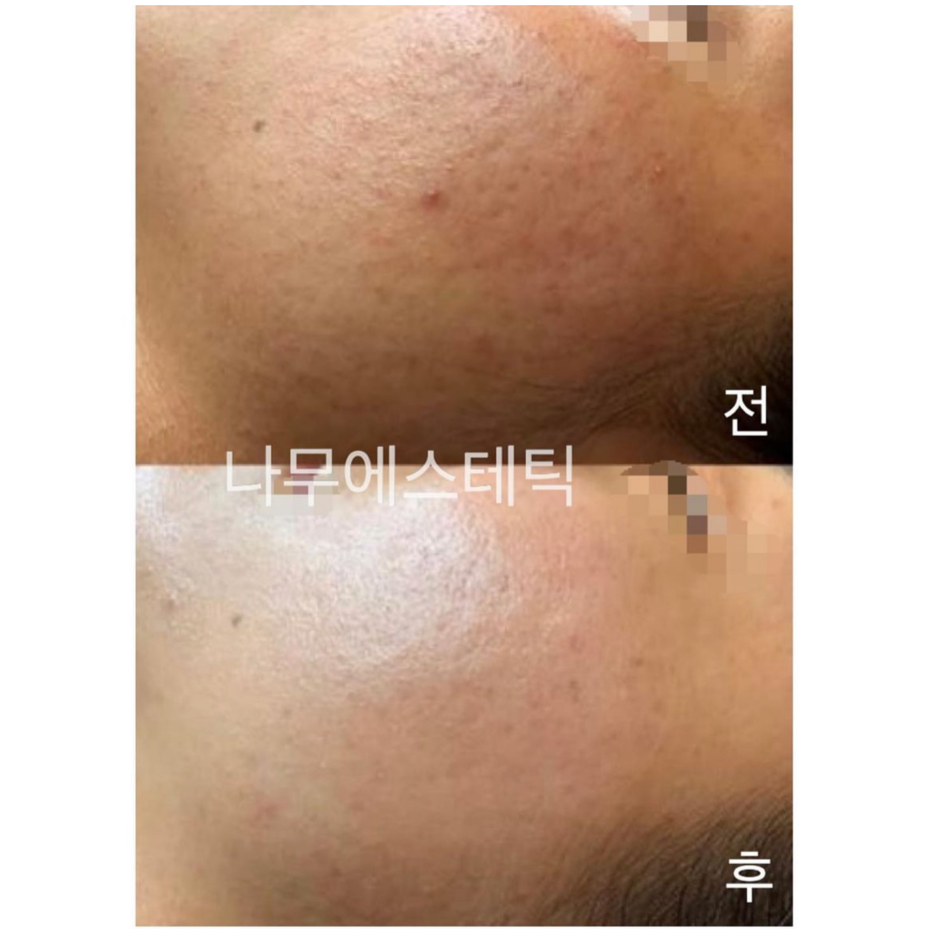 나무에스테틱 대표 이미지