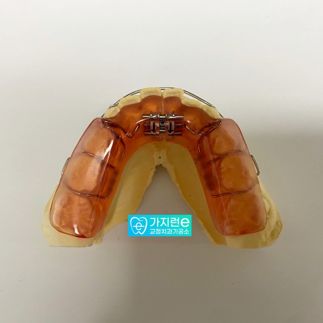 가지런e교정기공소 대표 이미지