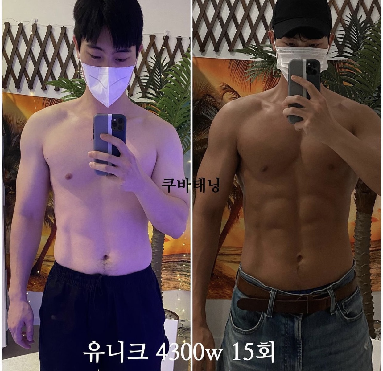 쿠바태닝 대표 이미지