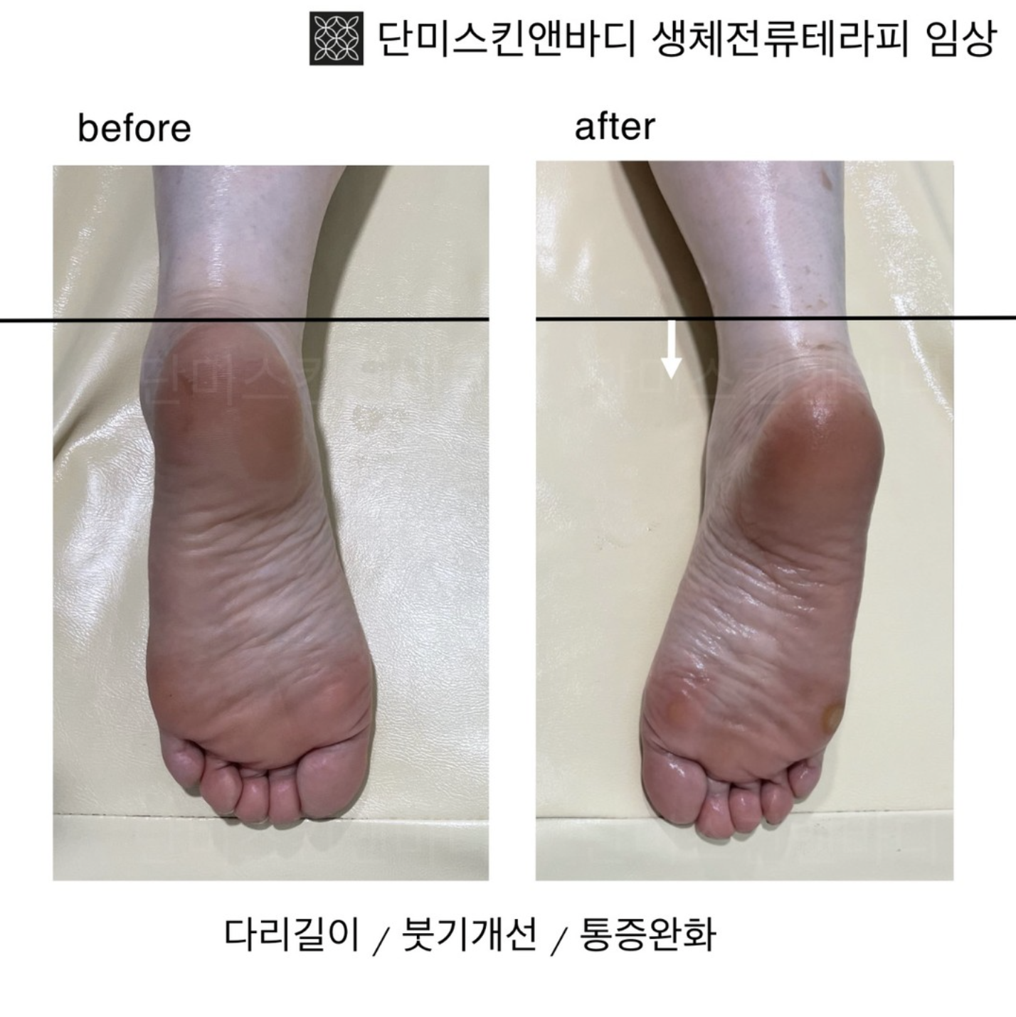 단미스킨앤바디
