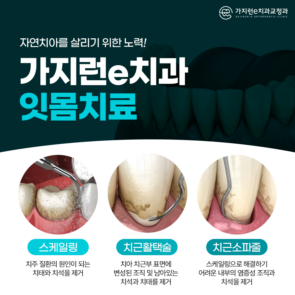 가지런e치과교정과치과의원