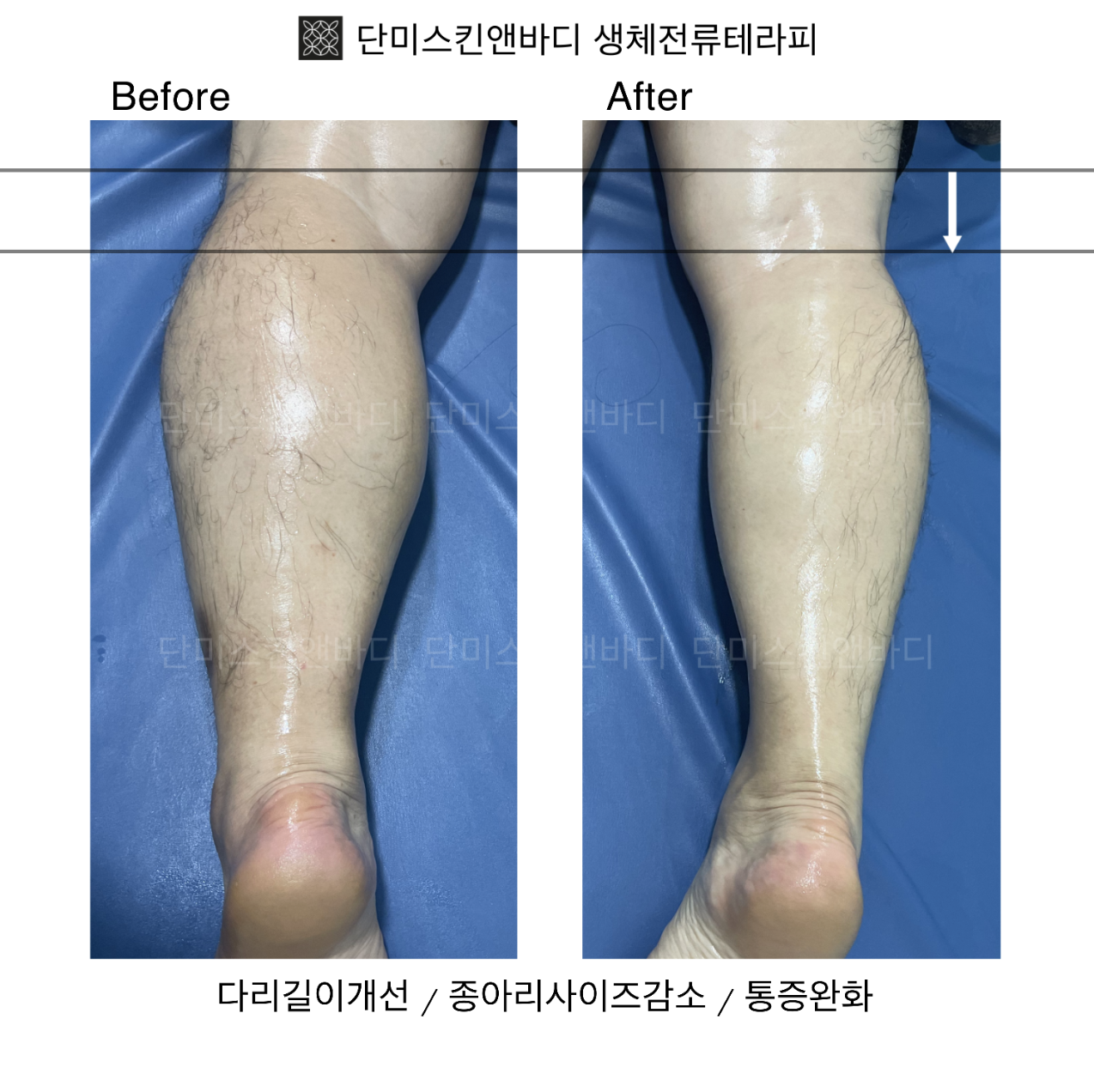 단미스킨앤바디
