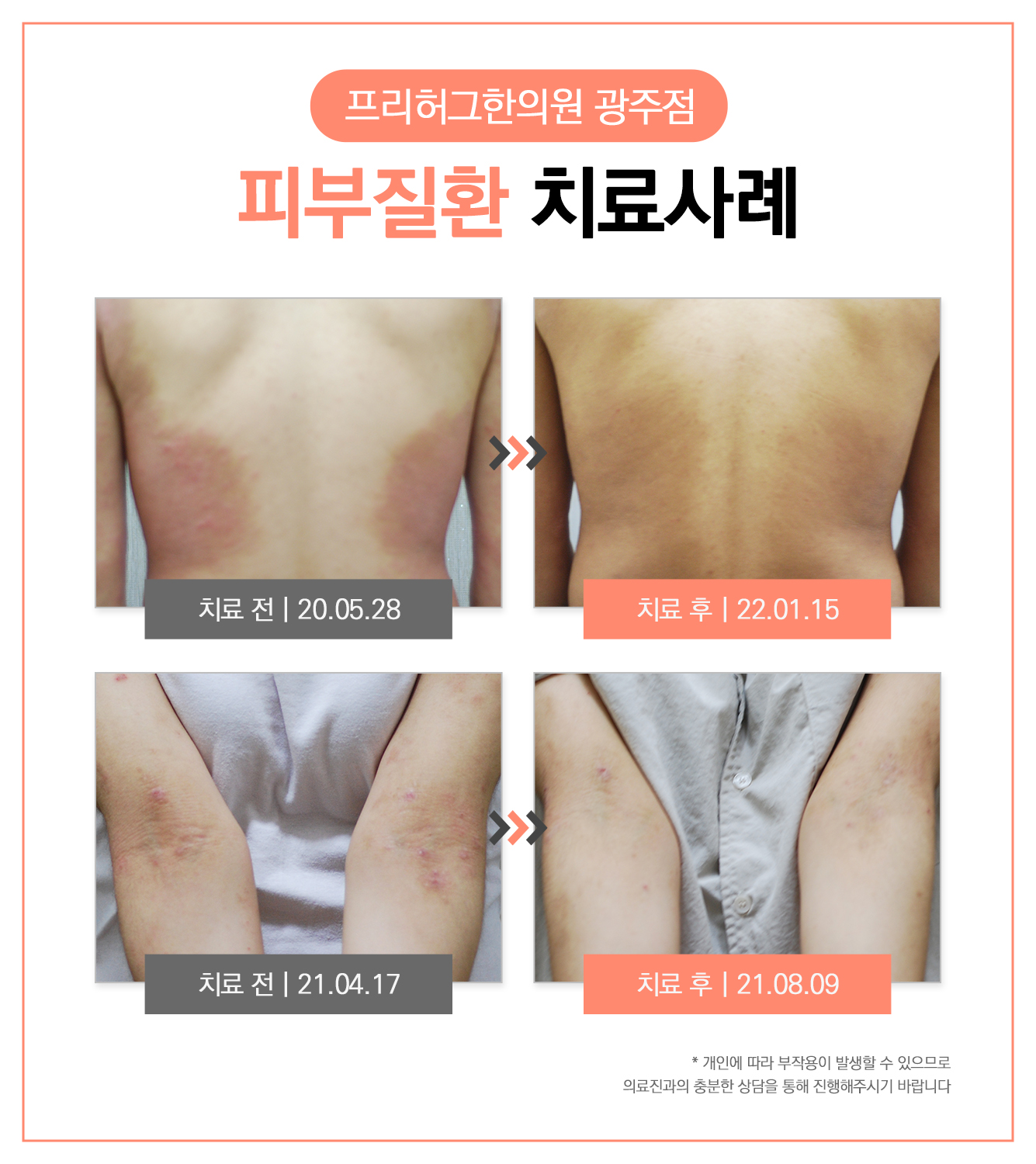 프리허그한의원 광주대표 이미지