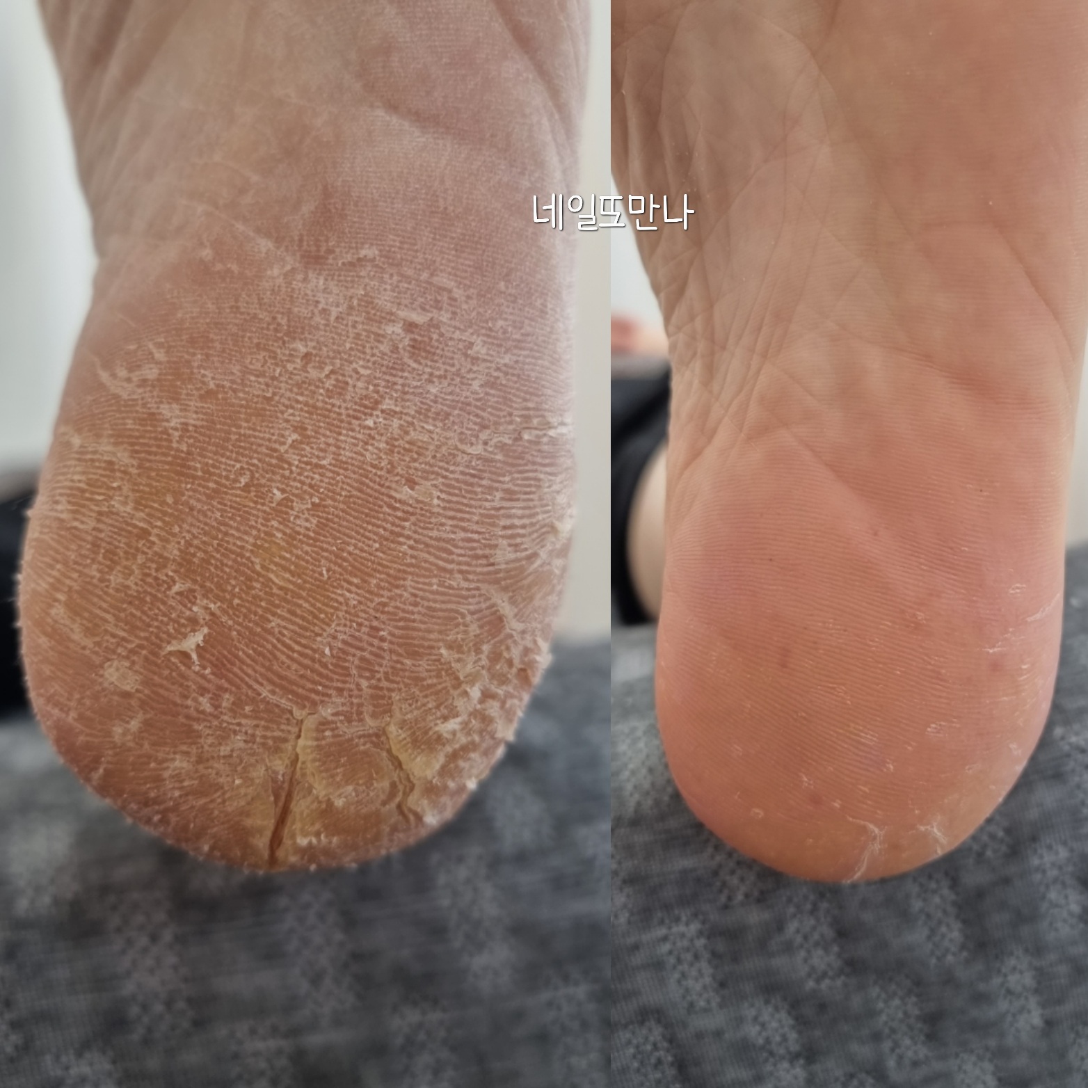 네일또만나