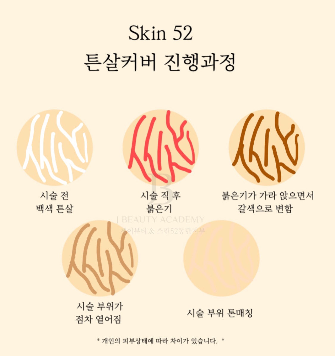 챠밍뷰티끄