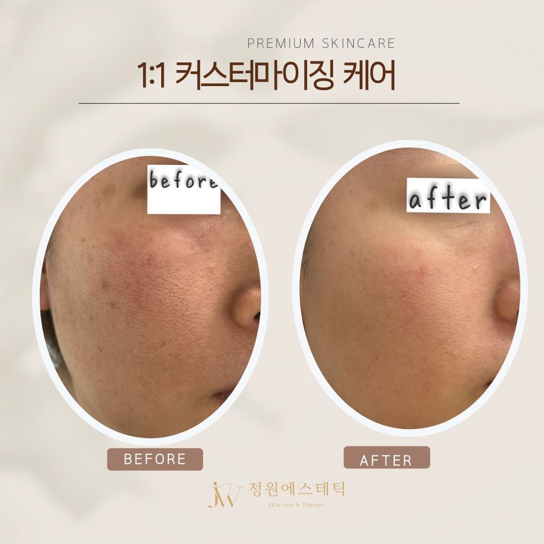 정원에스테틱 대표 이미지