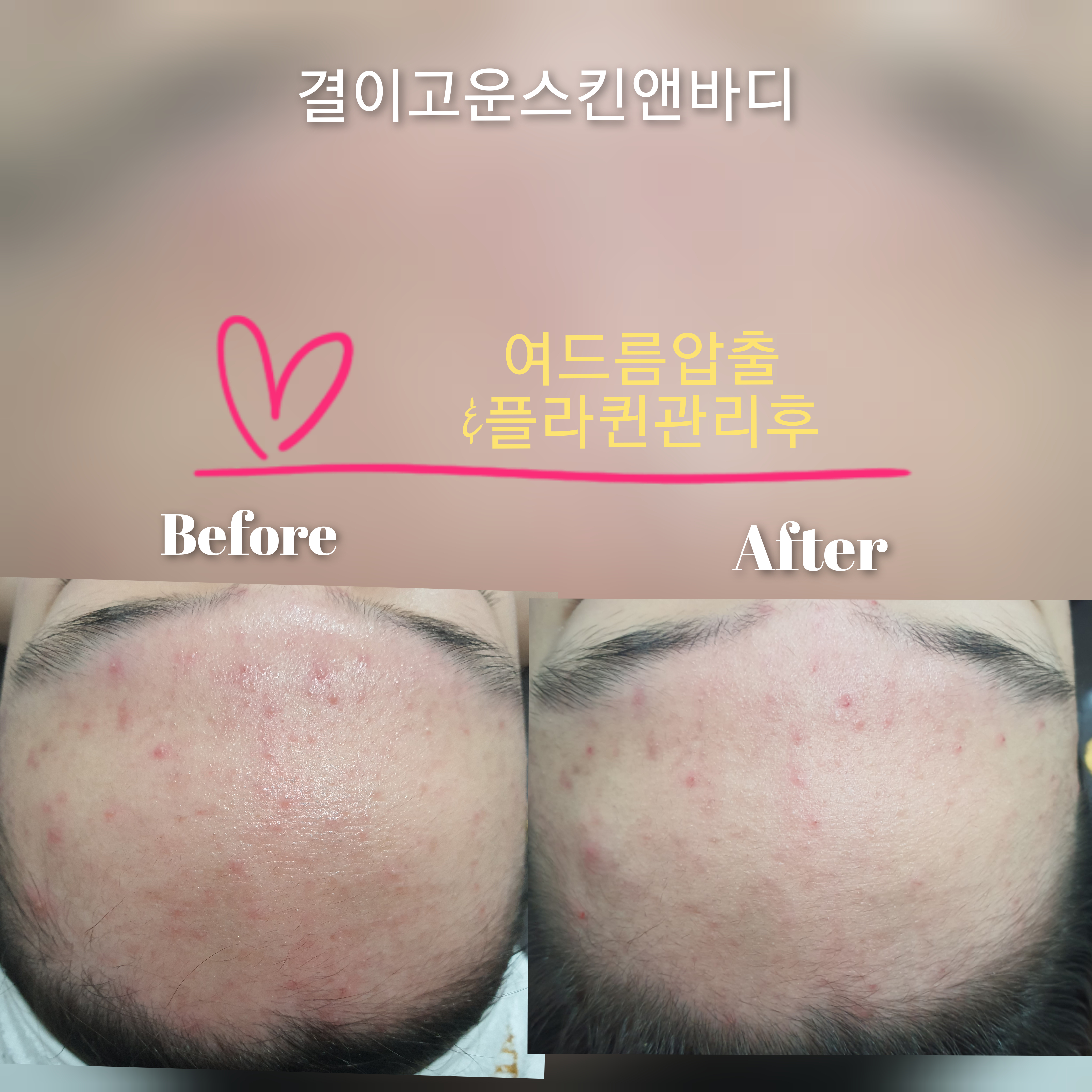 결이고운스킨앤바디