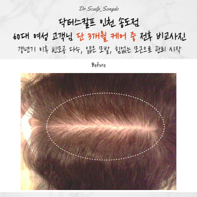 닥터스칼프 인천송도점