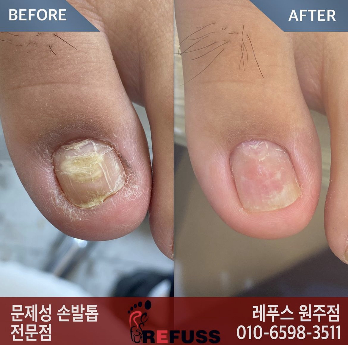 레푸스 원주점