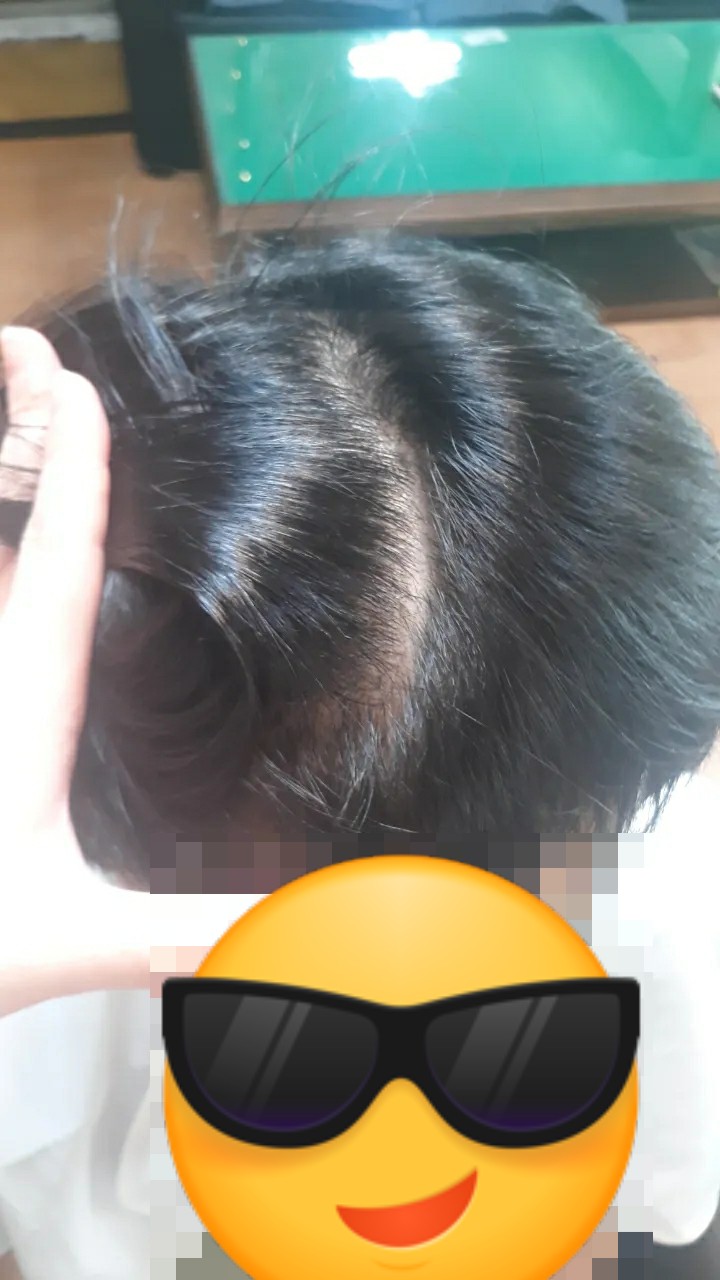 맨즈스칼프 대표 이미지