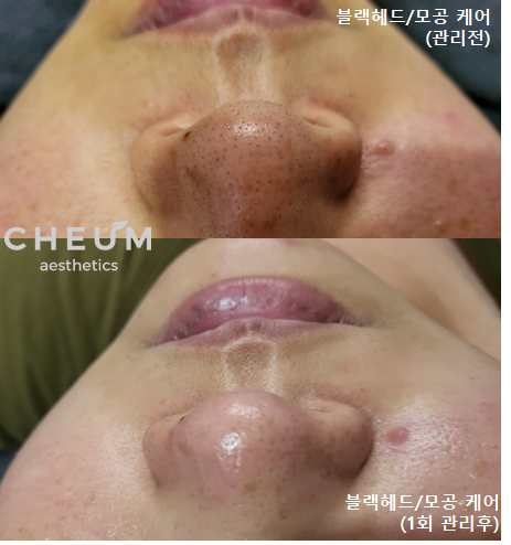 채움에스테틱