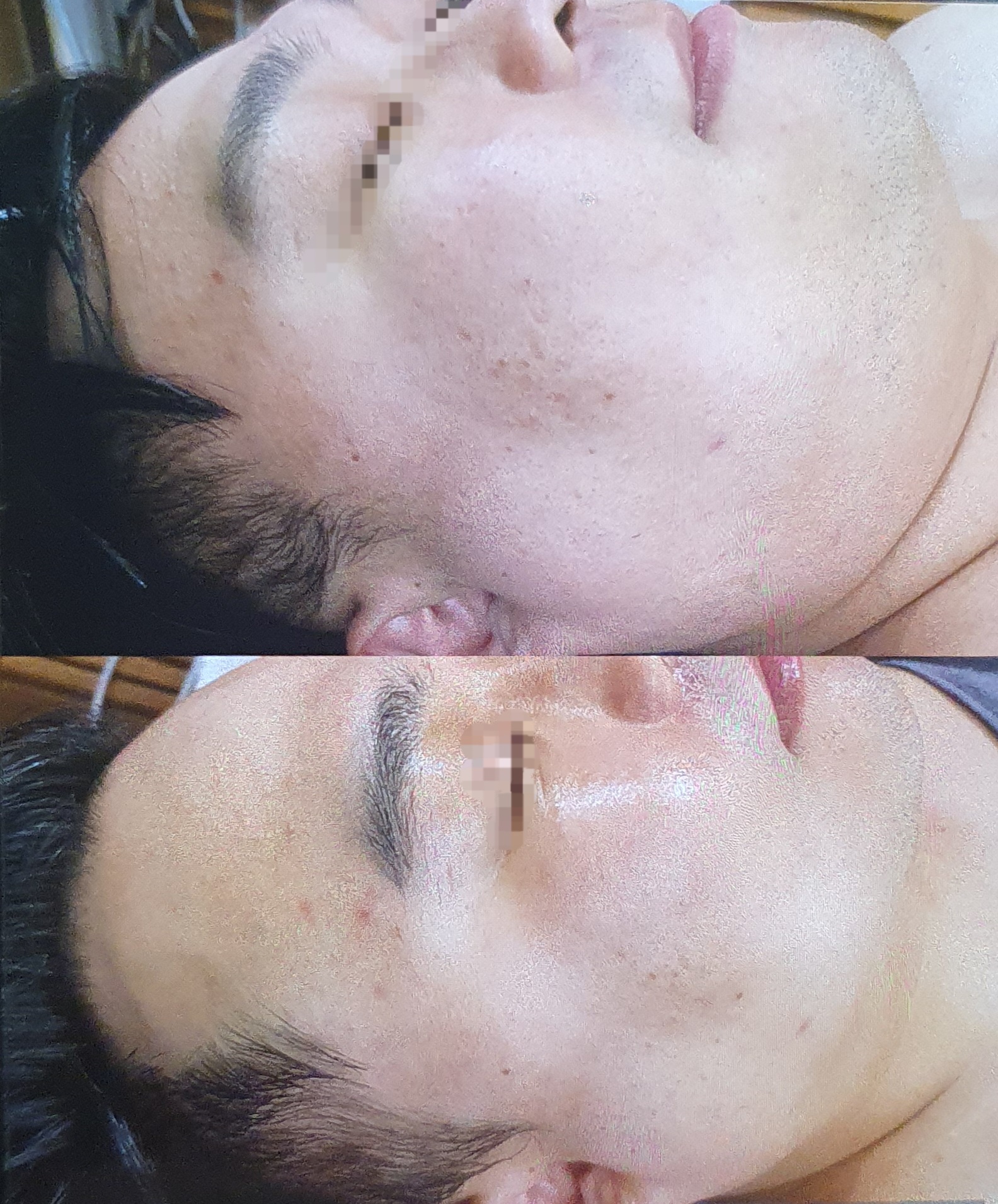더좋은피부