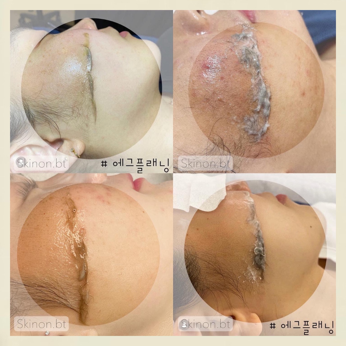 스킨온뷰티 대표 이미지