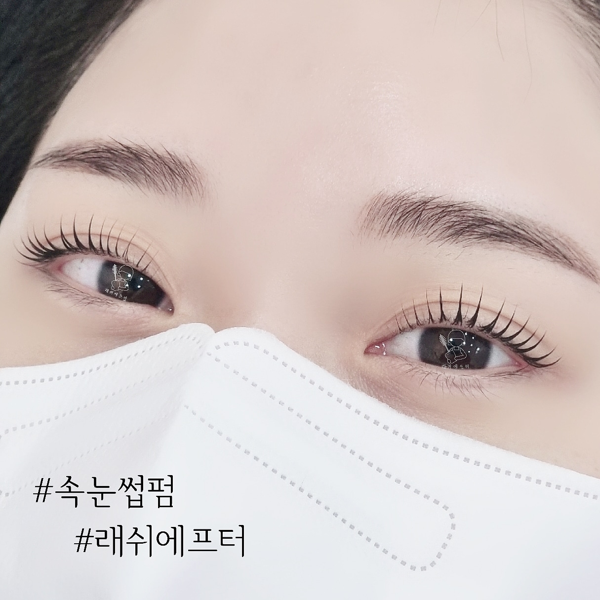 래쉬에프터 대표 이미지