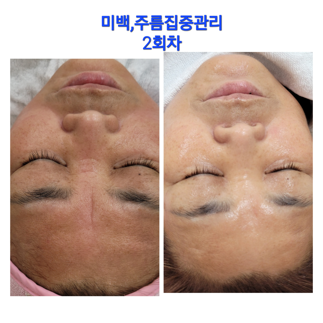 디에이치스킨스칼프