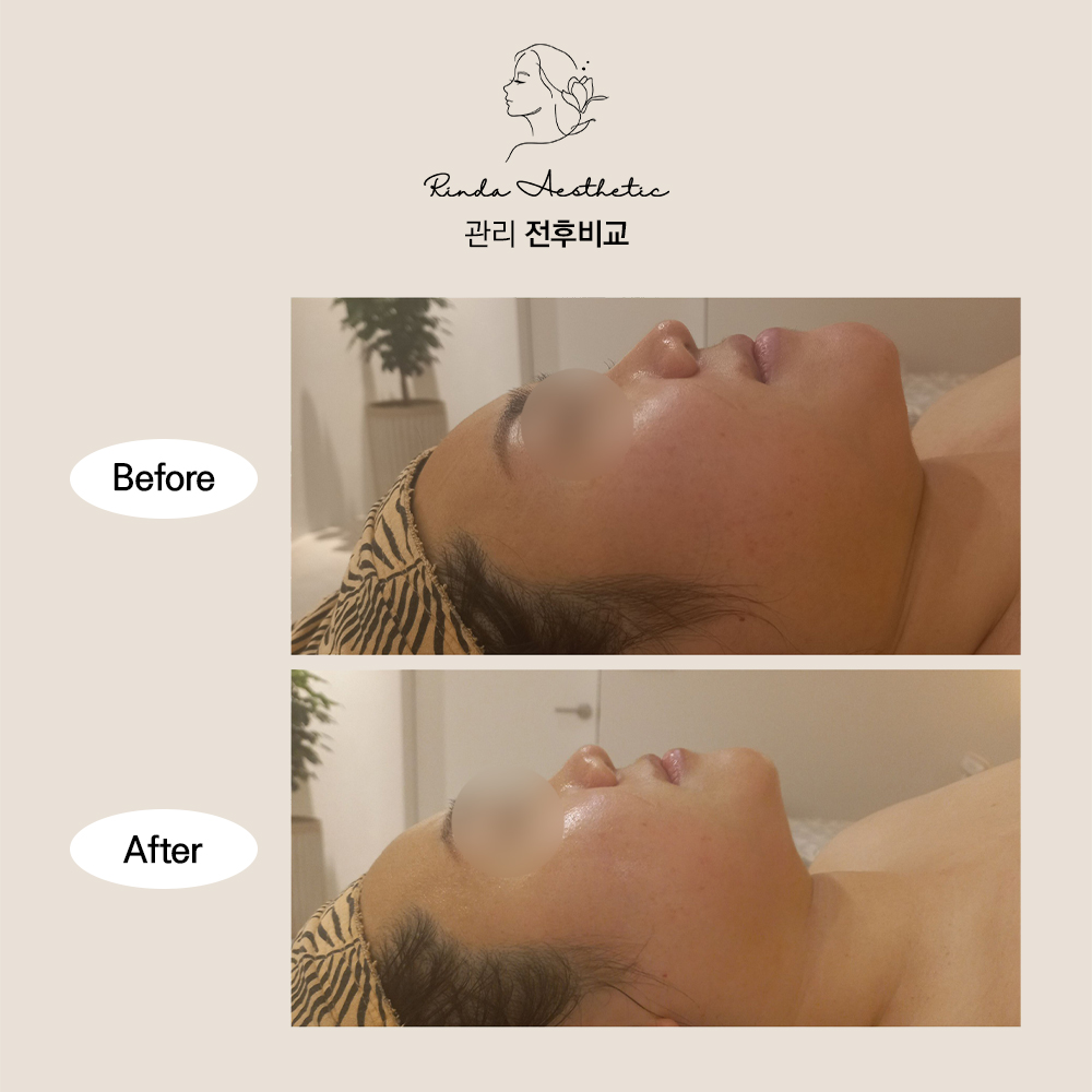 린다에스테틱