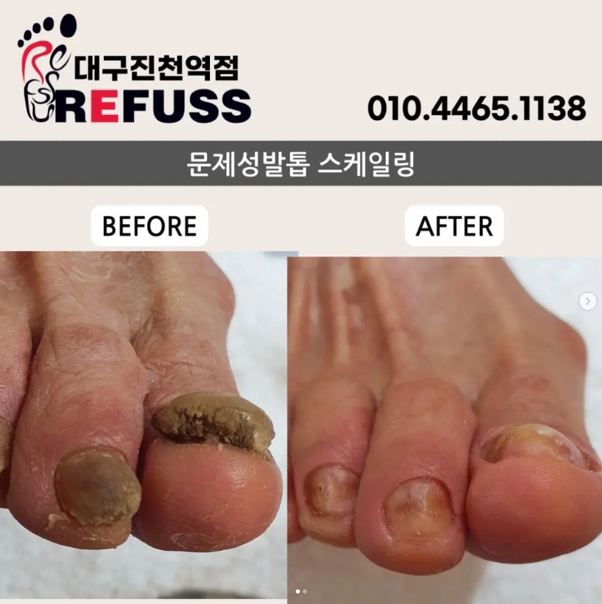 레푸스 진천역점