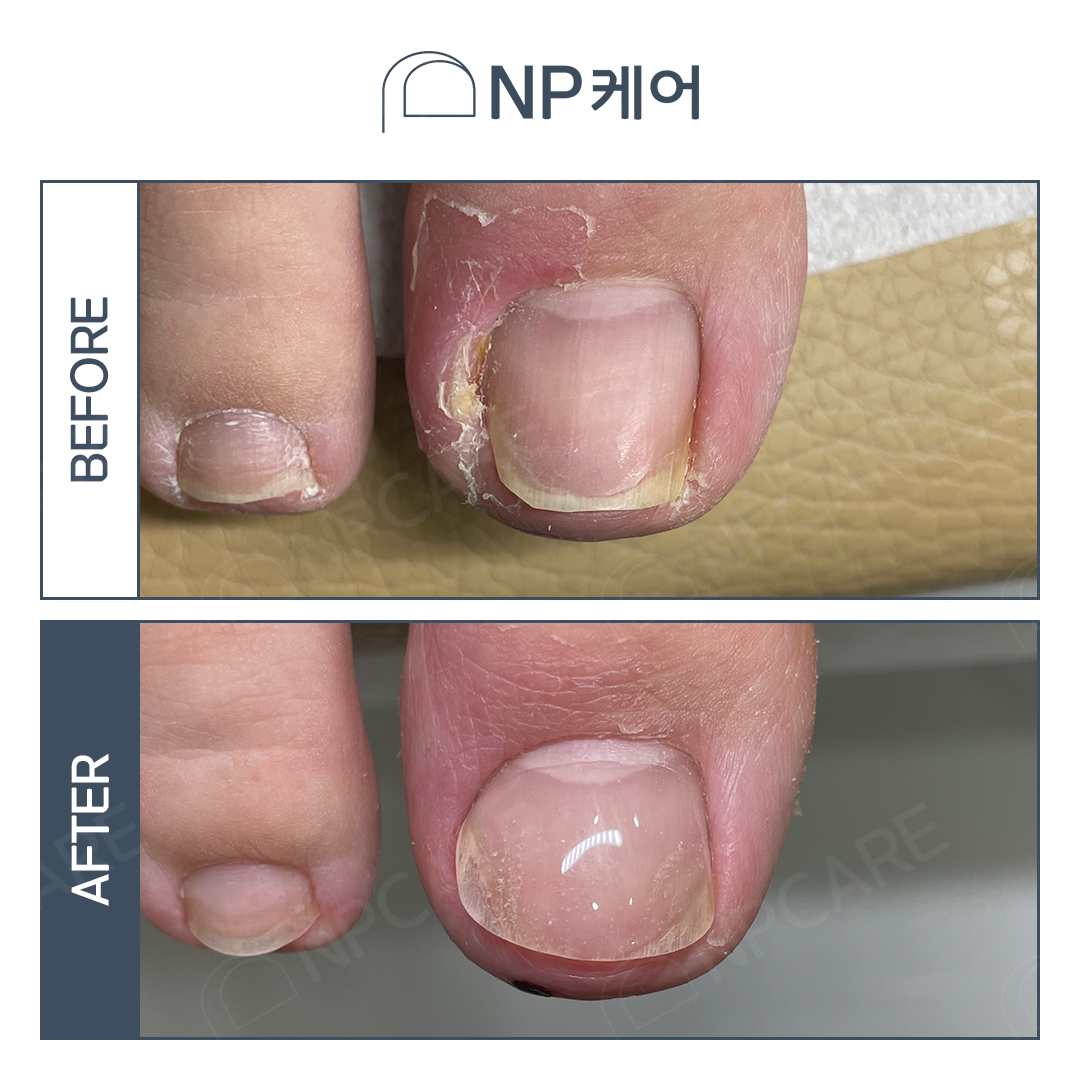 엔피케어 안양평촌점