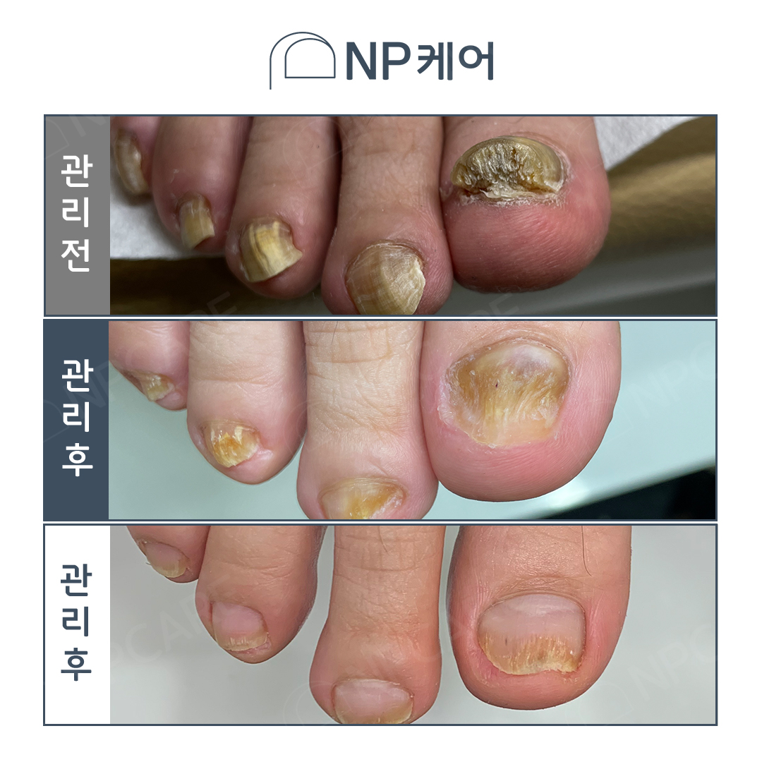 엔피케어 안양평촌점